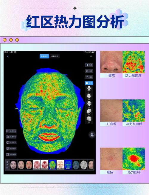 SEO技术分析皮肤图片